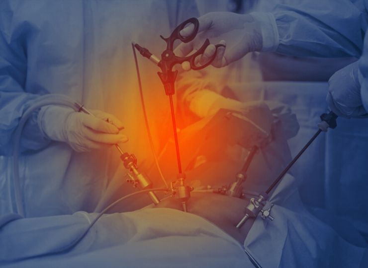 Laparoscopic Uterus Removal Surgery in Punjab